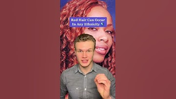 Thumbnail of Facts About Red Heads 👩‍🦰