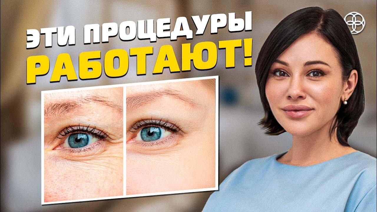 Самые эффективные процедуры от морщин вокруг глаз 2023! - YouTube