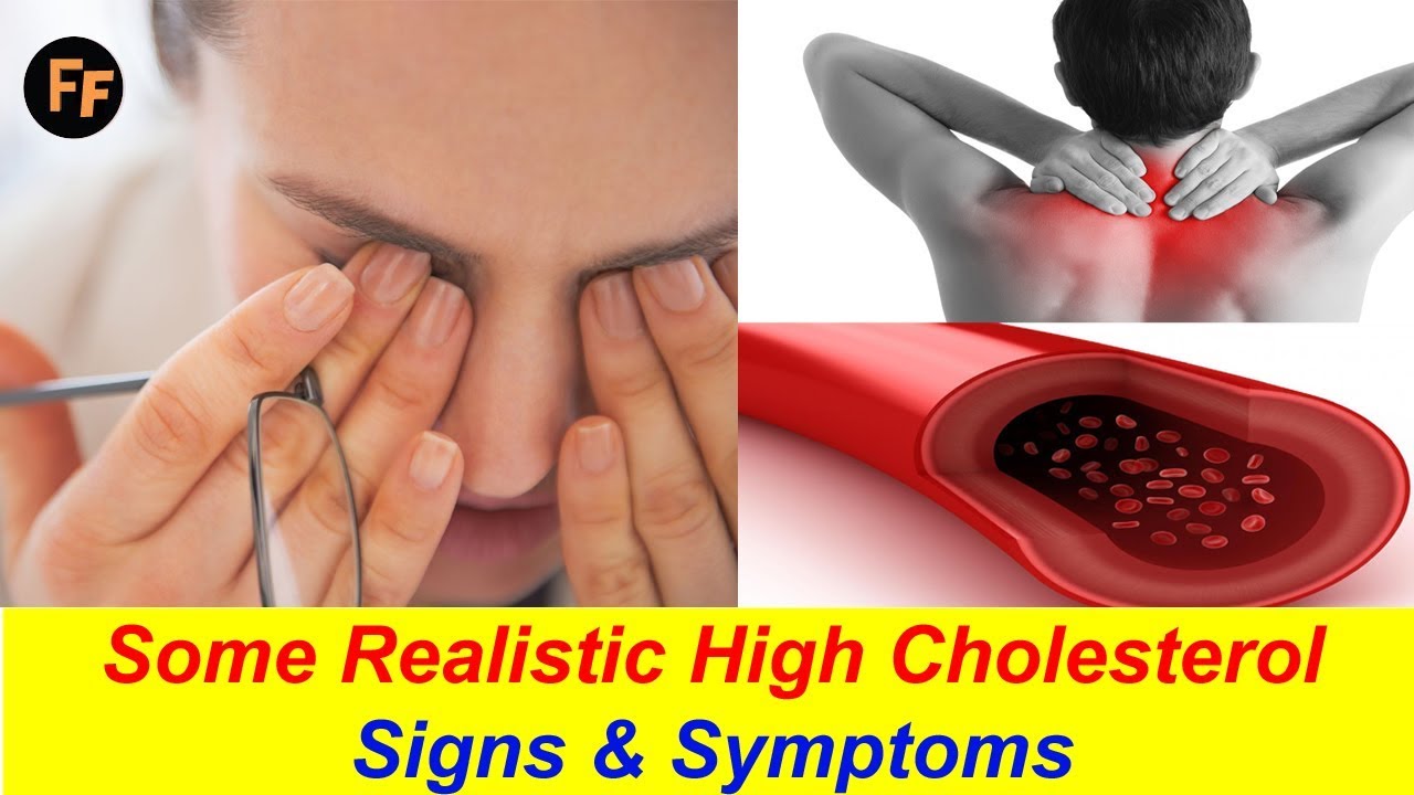 High Cholesterol Signs & Symptoms Common Signs of High Cholesterol