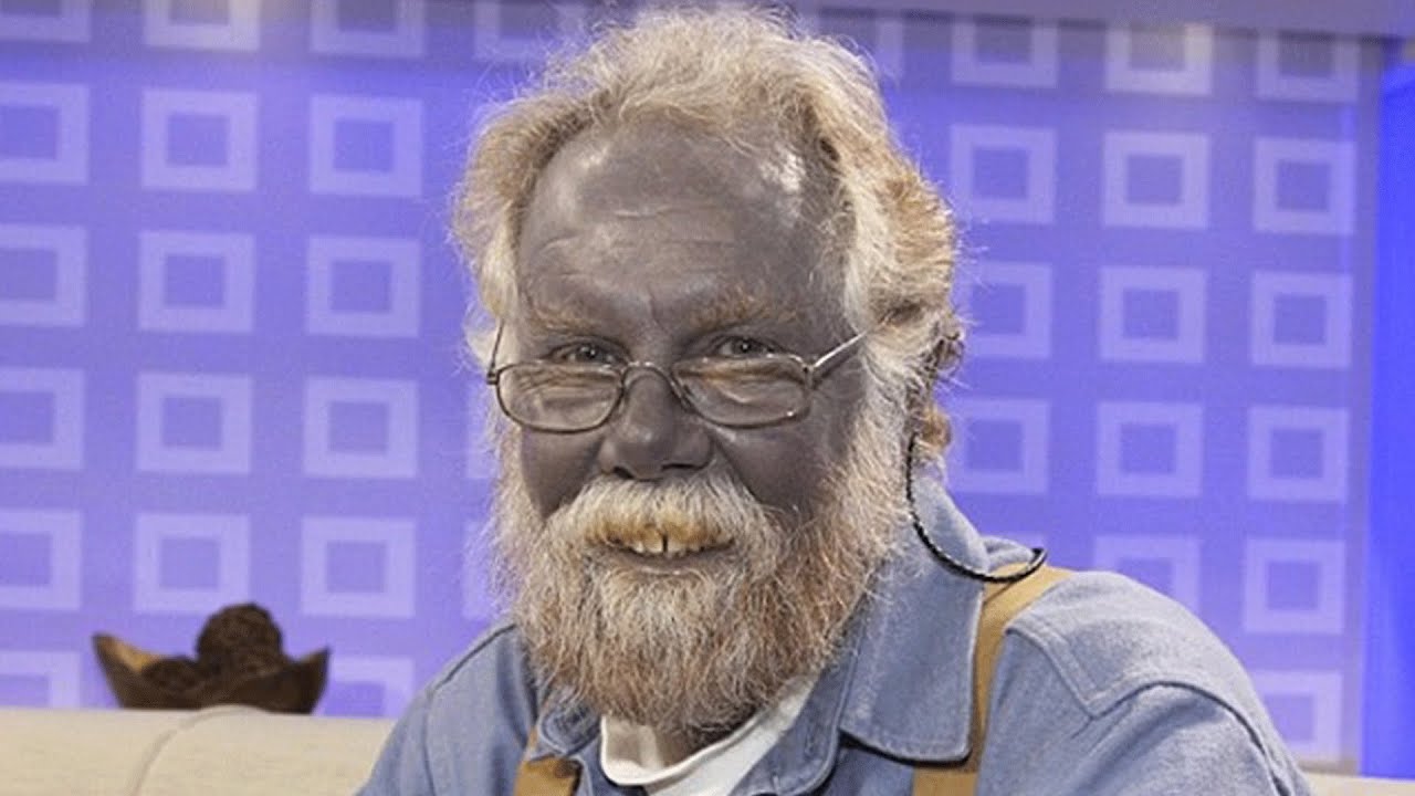 5 Weirdest Diseases YouTube