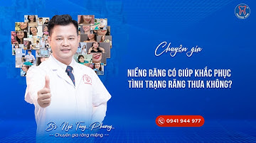 Niềng Răng Có Giúp Cải Thiện Vấn Đề Răng Thưa Không? Chuyên Gia Nha Khoa Giải Đáp