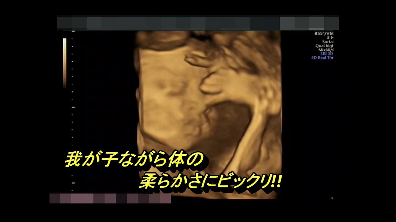 2d 4dエコー動画 女の子確定 Youtube 2d 4dエコー動画 女の子確定 Youtube