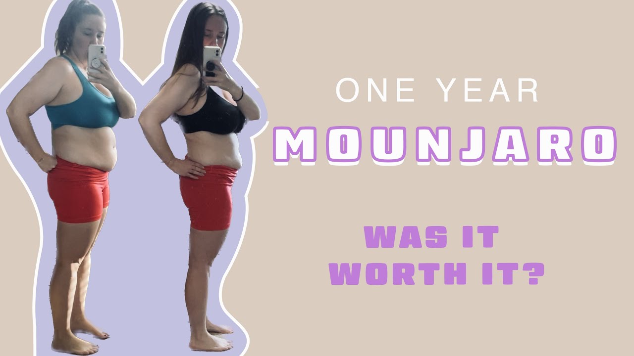mounjaro tirzepatide before and after Before and After: One Year Mounjaro Results!