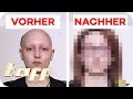 Antonia (19) hat extremen Haarausfall - Kann man ihr helfen? |SOS - Einsatz der Beauty-Retter | taff