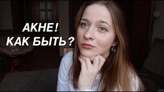 МОЕ ЛЕЧЕНИЕ АКНЕ ЧАСТЬ 1