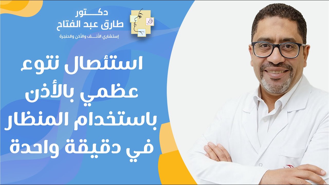 استئصال نتوء عظمي بالأذن باستخدام المنظار في دقيقة واحدة - YouTube