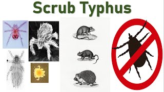 Scrub Typhus: A Chigger-Borne Disease | Rickettsial Fever | Chigger Mites | Rodents