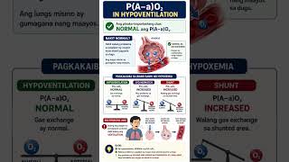 Differentiating the Causes of Hypoxemia 