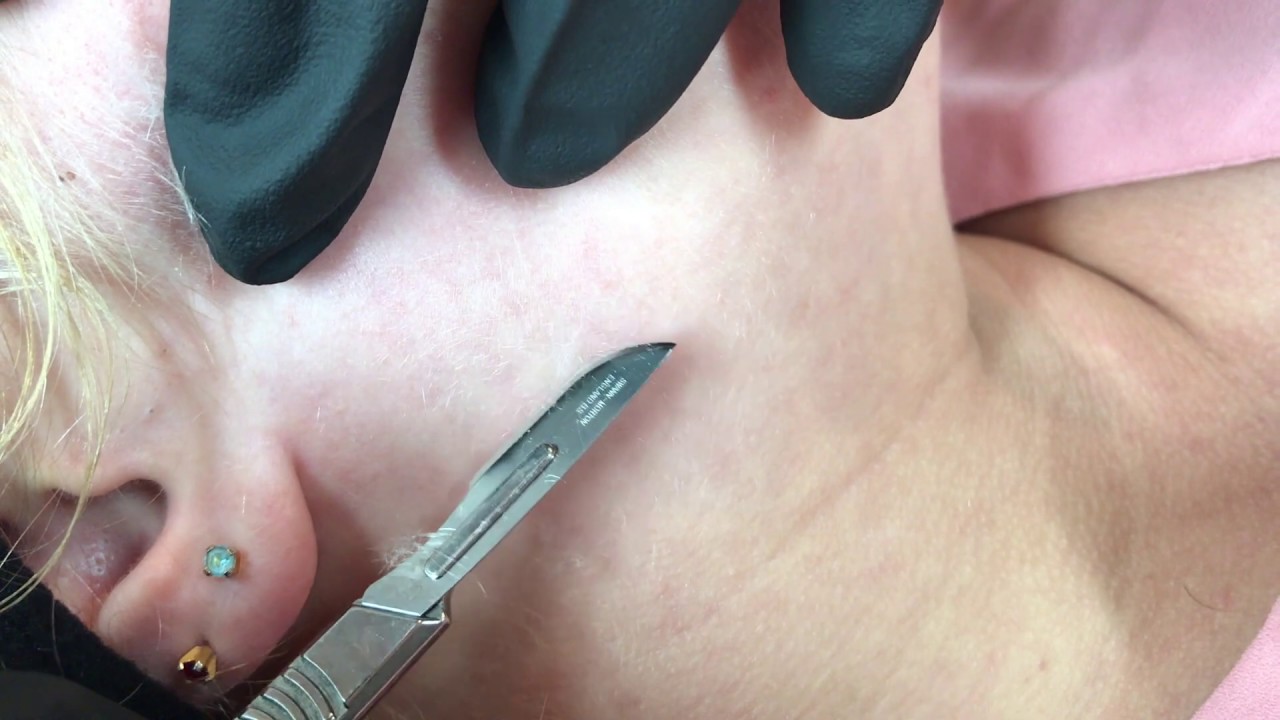 Dermaplaning Satisfying Exfoliating Treatment (ASMR)