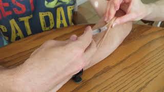 Fip Treatment Cat Injections Tenting The Skin And Injection