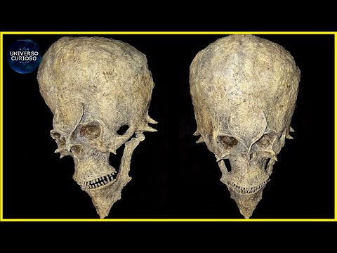 Vídeo: Esqueletos De 1700 Anos Descobertos No Peru - Visão Alternativa