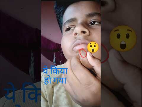 😨ये किया हो गया 😲 vlog#viral#minivlog#shortvideo#entertainment#feed#Ashish Vlog Br