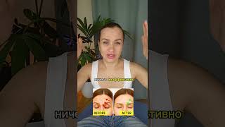 От морщин на лбу. Без уколов и операций #упражнениядлялица #фейсфитнес #гимнастикадлялица