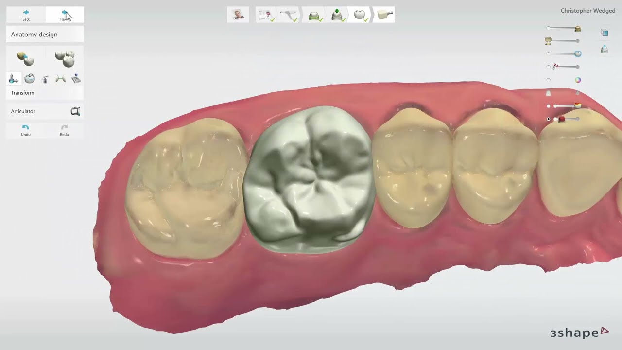 3Shape Video Thumbnail