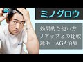ミノグロウ の効果と塗り方！リアップや他の「塗りミノ」となにが違うか比較してみた。