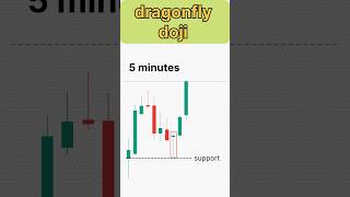 Dragonfly doji ki सच्चाई 😱 #shorts #chartpattern #candlestick