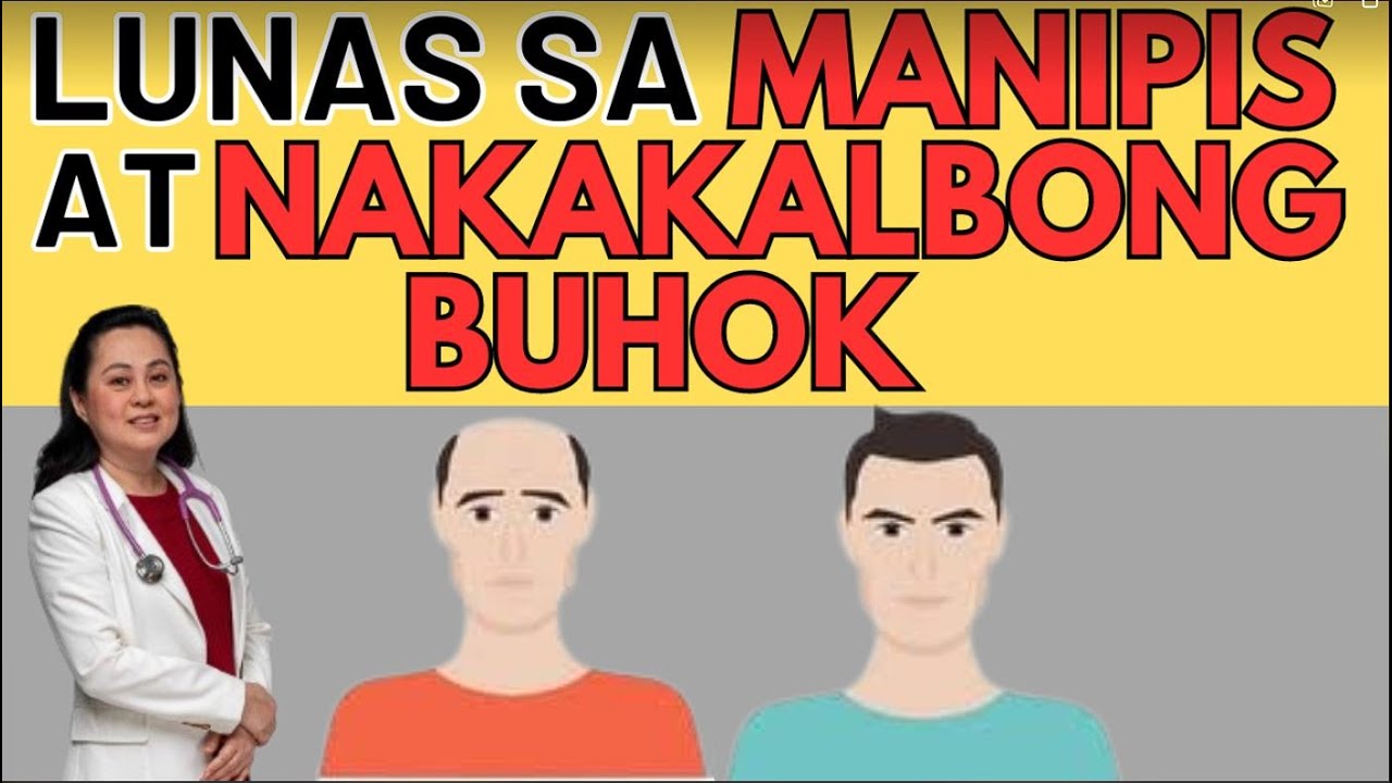 Lunas sa Manipis at Nakakalbong Buhok.- Tips By Doc Liza Ramoso-Ong ...