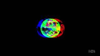 2019(?) Eijuba :: Wish @ 432 Hz