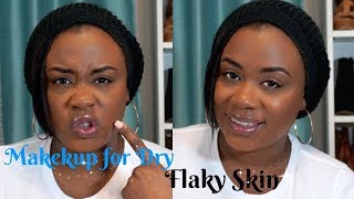 Dry & Flaky Skin Makeup Tutorial: Talk Thru Dry & Flaky Skin Makeup Tutorial: Talk Thru