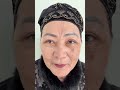 Blefaroplastika Toshkent  #blefaroplastika #plastikjarrox