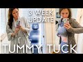 Tummy Tuck 3 Week Update | Before and After Pictures & Full Experience!