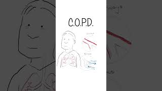 COPD  Explained #healthsketch #shorts