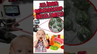 Jeli̇bon Mi̇kroskop İncelemesi̇ Ğlık