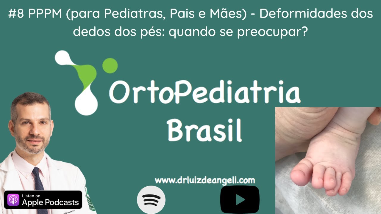 #8 PPPM (para Pediatras, Pais e Mães) - Deformidades dos dedos dos pés: quando se preocupar?