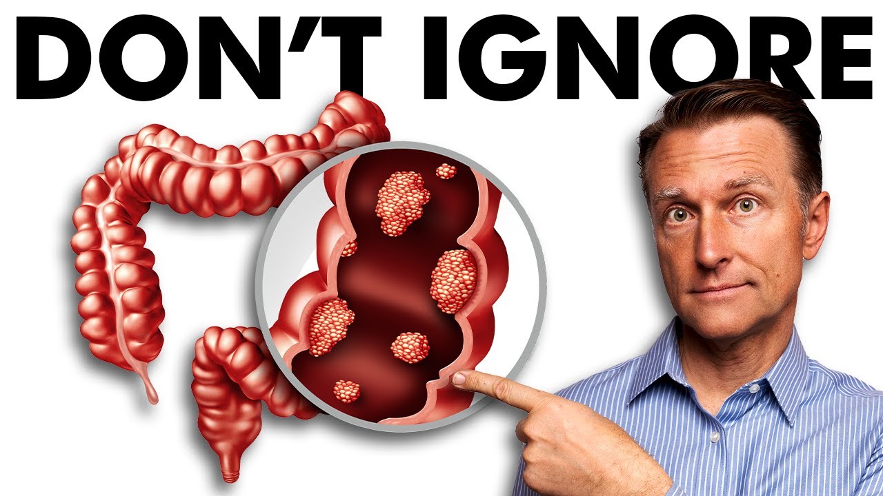 The Early Signs of Colon Cancer You DON'T Want to Ignore  -Dr Eric Berg