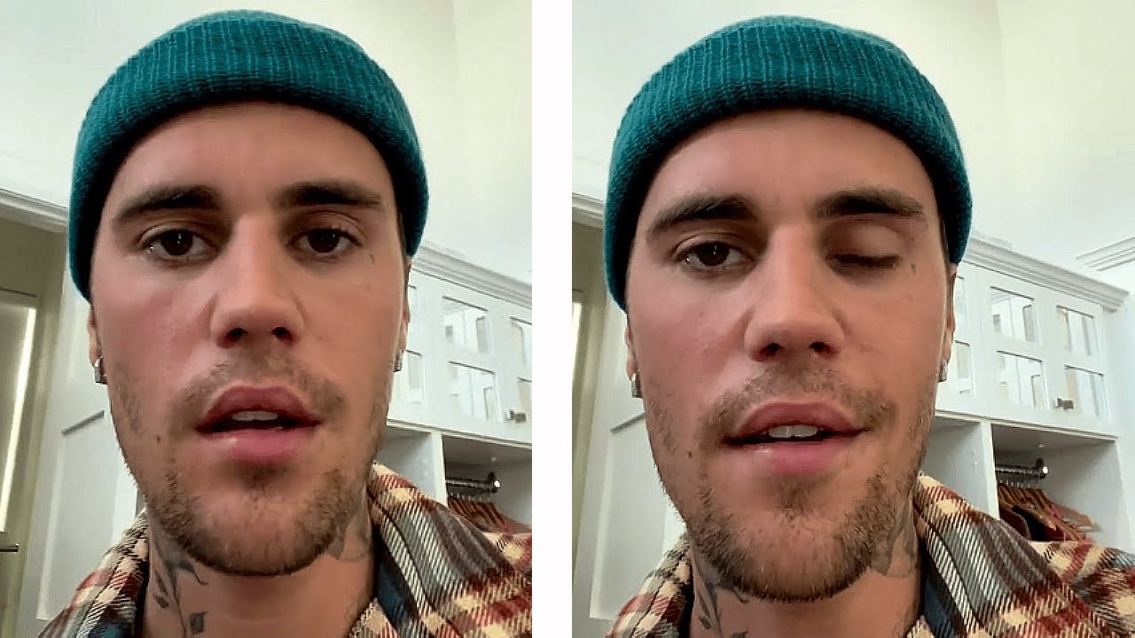 Justin Bieber revela que seu rosto está paralisado por causa de síndrome