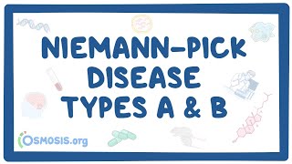 Niemann-Pick disease Types A and B - causes, symptoms, diagnosis, treatment, pathology Resimi