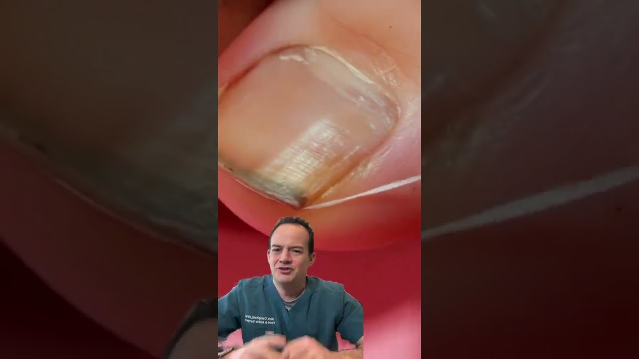 DOCTOR REACTS FLOSSING YOUR TOENAILS 