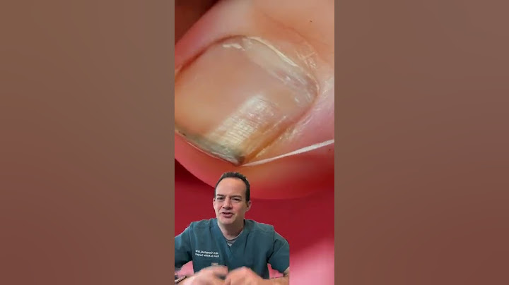 DOCTOR REACTS: FLOSSING YOUR TOENAILS?!😱😳