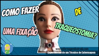 Como fazer Fixação de Traqueostomia