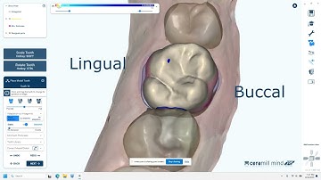 Amann Girrbach Ceramill Mind DRS workflow #14 crown