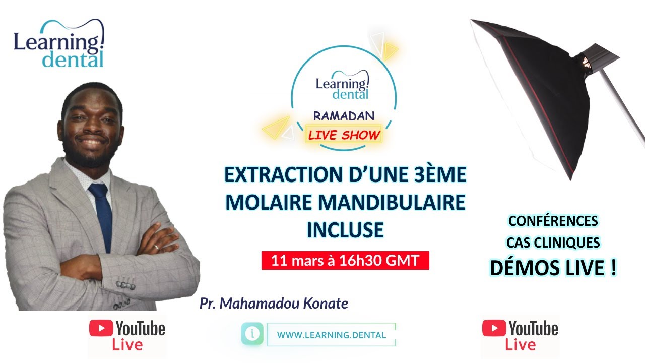 Extraction d’une 3ème molaire mandibulaire incluse