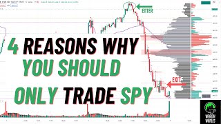 Trading Was Hard Until I Focused On Spy Day Trading Spy Options Spy Spx Es Vix