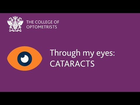 How might cataracts affect my vision?