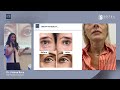 Sunekos il protocollo per la medicina estetica rigenerativa