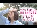 Tips Menghilangkan Flek Hitam