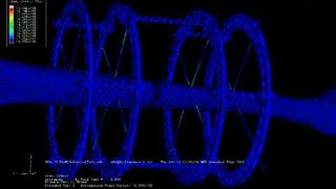 Finite element stress analysis of Ilizarov frame for tibia
