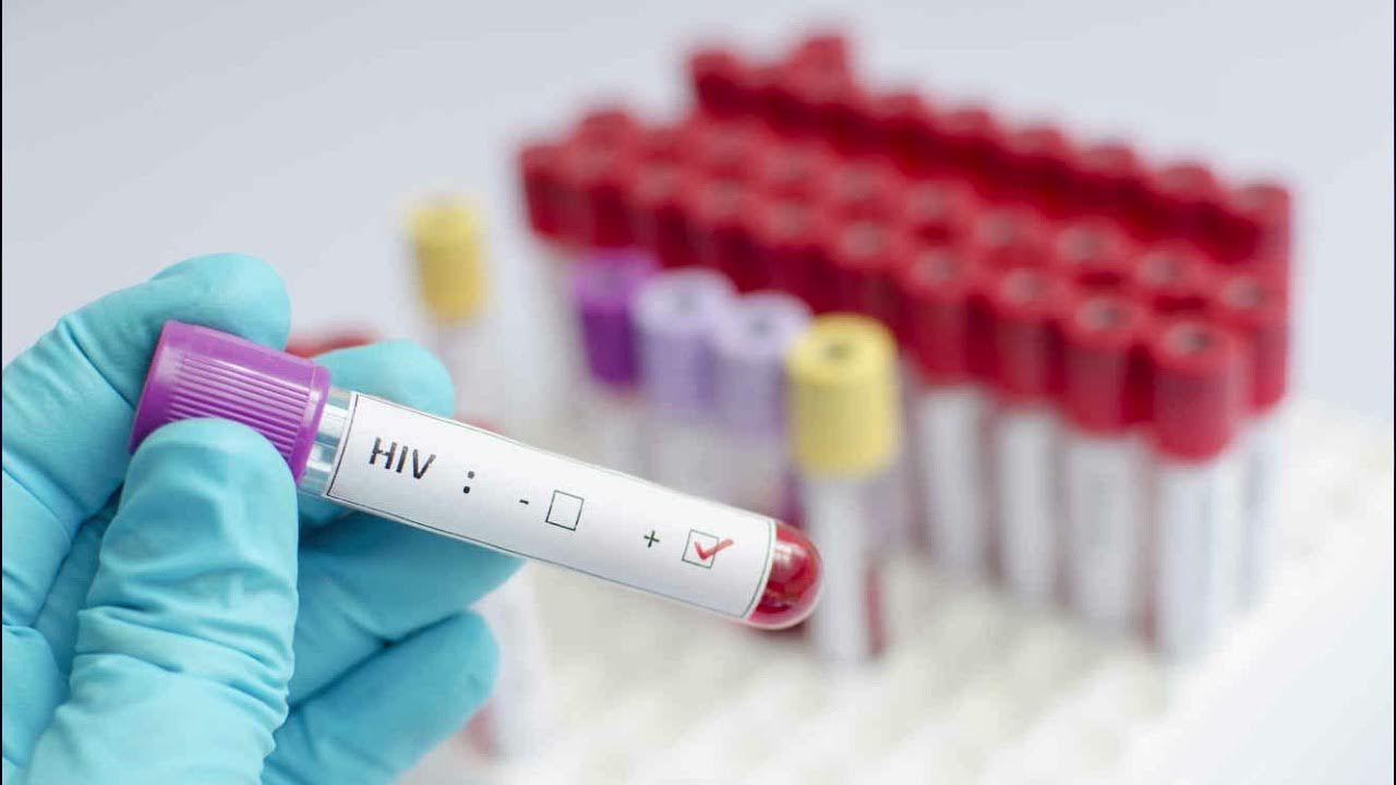 Какая пробирка на вич. Вич пробирка. Вич пробирка. Гепатит пробирка. Какая пробирка на вич.
