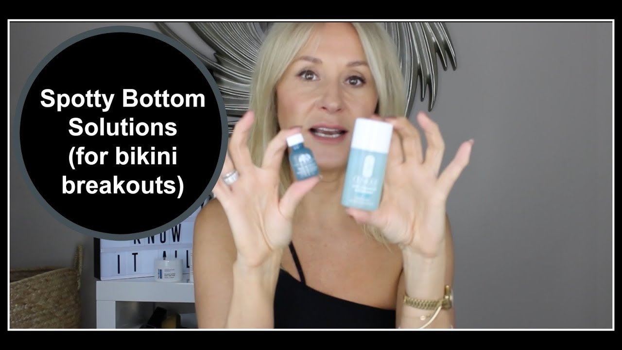 BEST ACIDS FOR BODY BREAKOUTS Nadine Baggott YouTube