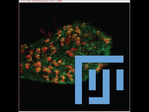 How To Count Cells In 3d Using Imagej Fiji