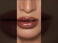 تعديل الشفايف
