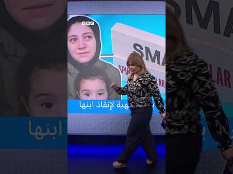 أم مصرية تواجه تحديات الضمور العضلي الشوكي لطفلها