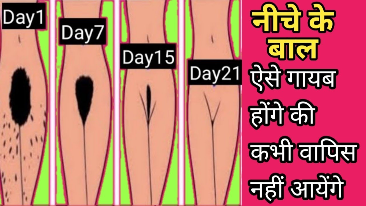 नीचे के बालों से छुटकारा | Private Part Ke Hair Kaise Remove Kare Gharelu  Upay | Yoni Ke baal Khatam - YouTube