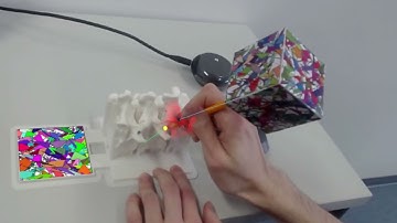 Medical Augmented Reality: Pedicle Screw Insertion Surgery Guidance Prototype