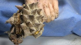 ASMR Toenails Cutting