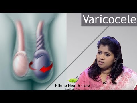 varicocele-treatment-|-cure-permanently-in-hindi-|-ethnic-health-care-varicocele-natural-treatment
